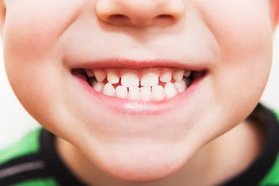 Partial picture of male child's face exposing teeth in a smile.